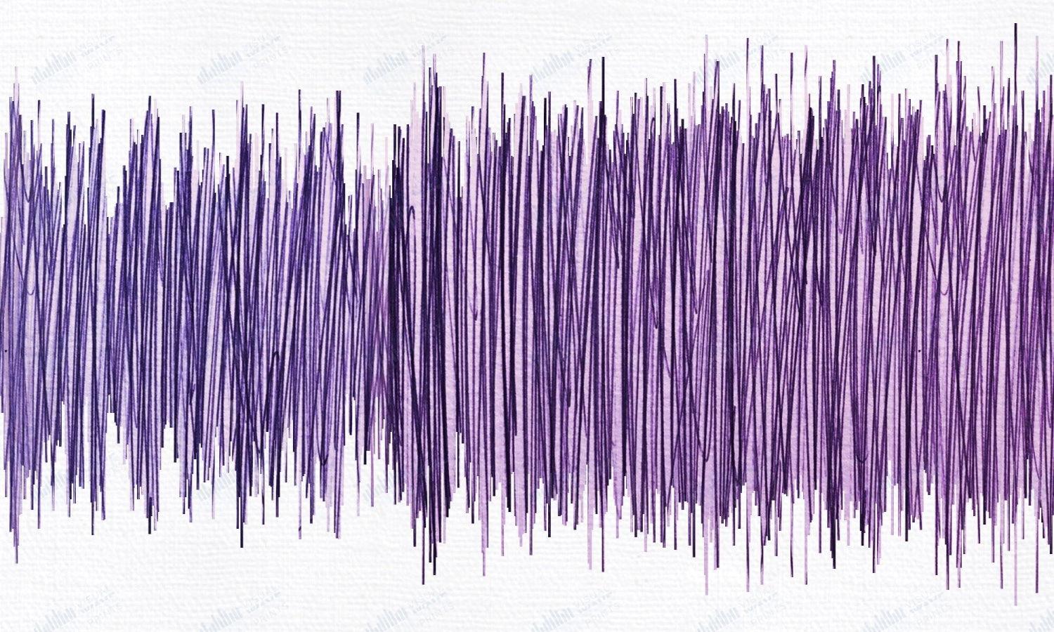 Comfortably Numb by Pink Floyd - Visual Wave Prints
